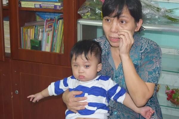 ベトナム目に障害のある赤ちゃん